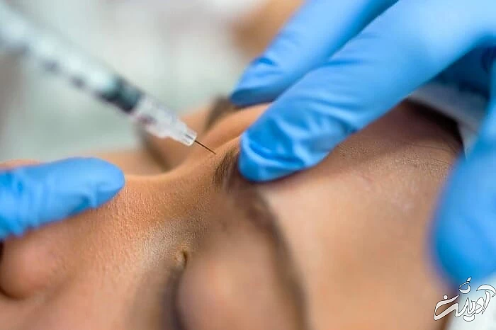 مزوبوتاکس چیست بوتاکس